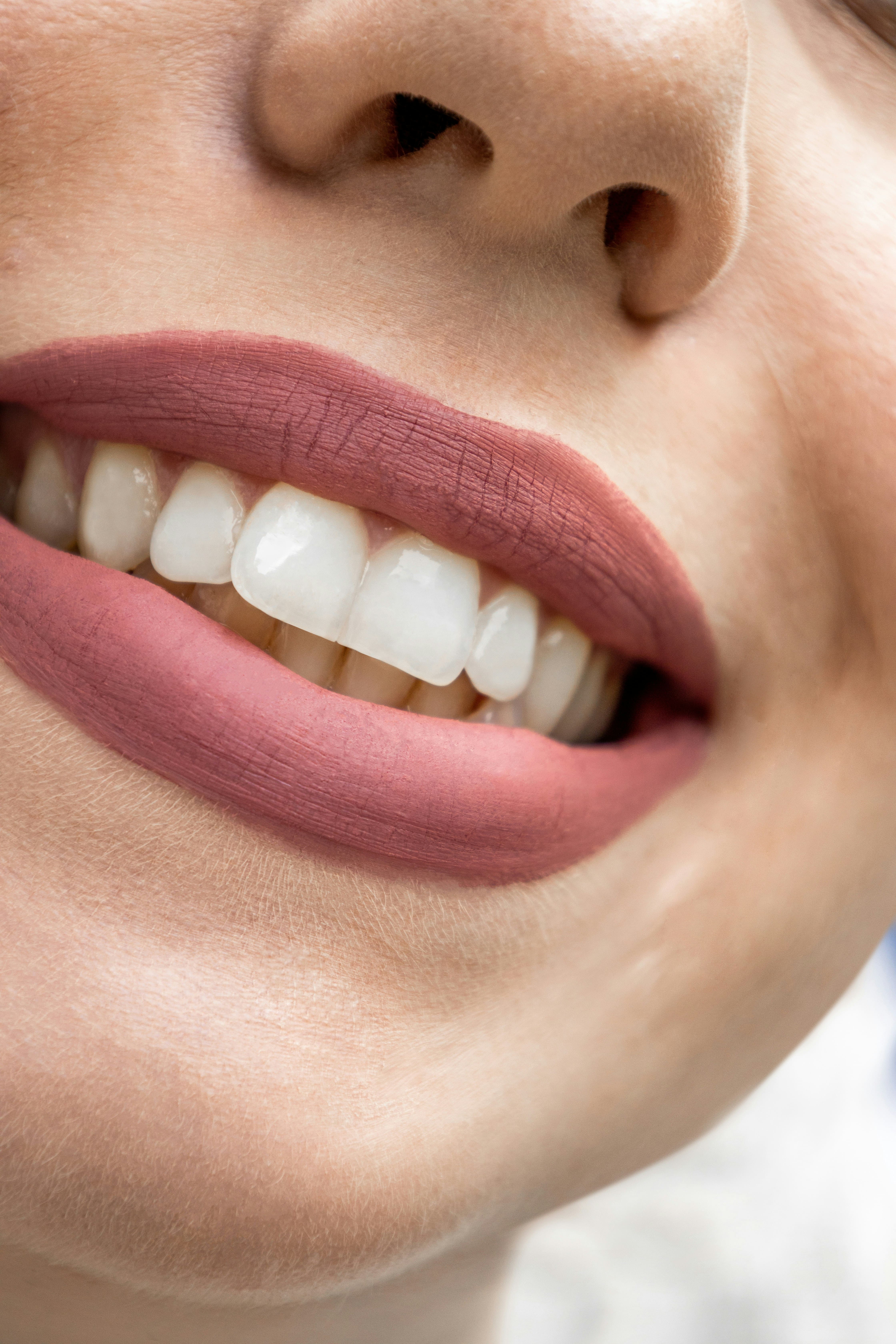 Sonrisa después del tratamiento
